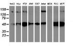 HDAC6 Antibody in Western Blot (WB)