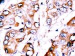 HDBP2 Antibody in Immunohistochemistry (IHC)