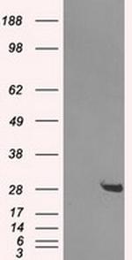 HDHD2 Antibody in Western Blot (WB)