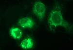 HERPUD1 Antibody in Immunocytochemistry (ICC/IF)
