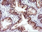 HERPUD1 Antibody in Immunohistochemistry (Paraffin) (IHC (P))