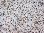 HES1 Antibody in Immunohistochemistry (Paraffin) (IHC (P))