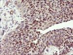 HES1 Antibody in Immunohistochemistry (Paraffin) (IHC (P))