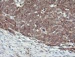 HES1 Antibody in Immunohistochemistry (Paraffin) (IHC (P))