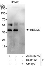 HEXIM2 Antibody in Immunoprecipitation (IP)