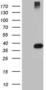 HFE2 Antibody in Western Blot (WB)