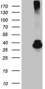 HFE2 Antibody in Western Blot (WB)