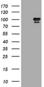 HGS Antibody in Western Blot (WB)