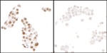 HIF1-alpha Antibody in Immunocytochemistry (ICC/IF)