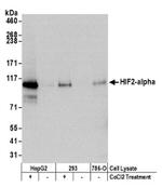 HIF2-alpha Antibody in Western Blot (WB)