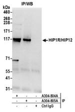 HIP1R/HIP12 Antibody in Western Blot (WB)