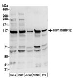 HIP1R/HIP12 Antibody in Western Blot (WB)