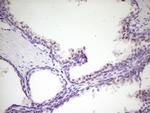 HIPK1 Antibody in Immunohistochemistry (Paraffin) (IHC (P))