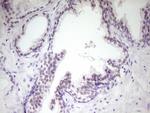 HIPK1 Antibody in Immunohistochemistry (Paraffin) (IHC (P))