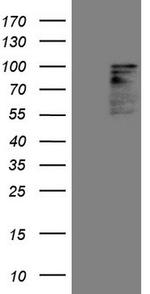 HIPK1 Antibody in Western Blot (WB)