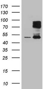 HIPK1 Antibody in Western Blot (WB)