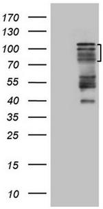 HIPK1 Antibody in Western Blot (WB)