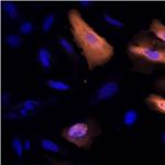 6x-His Tag Antibody in Immunocytochemistry (ICC/IF)