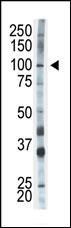 HK1 Antibody in Western Blot (WB)