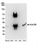 HLA-DR Antibody in Western Blot (WB)