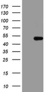 HMBS Antibody in Western Blot (WB)