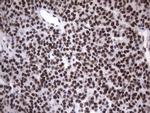 HNRNPA0 Antibody in Immunohistochemistry (Paraffin) (IHC (P))