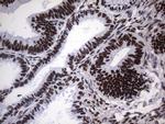 HNRNPA0 Antibody in Immunohistochemistry (Paraffin) (IHC (P))