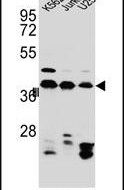 hnRNP C Antibody in Western Blot (WB)