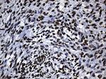 HNRNPH1 Antibody in Immunohistochemistry (Paraffin) (IHC (P))