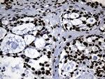 HNRNPH1 Antibody in Immunohistochemistry (Paraffin) (IHC (P))