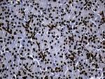 HNRNPH1 Antibody in Immunohistochemistry (Paraffin) (IHC (P))