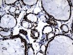 HNRNPH1 Antibody in Immunohistochemistry (Paraffin) (IHC (P))