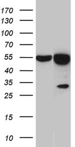 HNRNPH1 Antibody in Western Blot (WB)