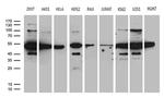 HNRNPH1 Antibody in Western Blot (WB)