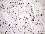 HNRNPL Antibody in Immunohistochemistry (Paraffin) (IHC (P))