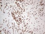 HNRNPL Antibody in Immunohistochemistry (Paraffin) (IHC (P))