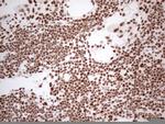 HNRNPL Antibody in Immunohistochemistry (Paraffin) (IHC (P))