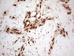 HNRNPL Antibody in Immunohistochemistry (Paraffin) (IHC (P))