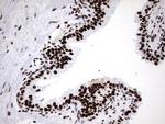 HNRNPM Antibody in Immunohistochemistry (Paraffin) (IHC (P))