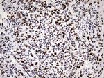 HNRNPM Antibody in Immunohistochemistry (Paraffin) (IHC (P))