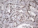 HNRNPM Antibody in Immunohistochemistry (Paraffin) (IHC (P))