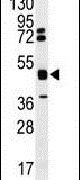 hnRNP K Antibody in Western Blot (WB)