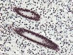 HOXC11 Antibody in Immunohistochemistry (Paraffin) (IHC (P))