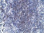 HOXC11 Antibody in Immunohistochemistry (Paraffin) (IHC (P))