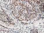 HOXC11 Antibody in Immunohistochemistry (Paraffin) (IHC (P))