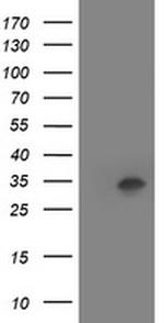 HOXC11 Antibody in Western Blot (WB)