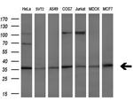 HOXC11 Antibody in Western Blot (WB)