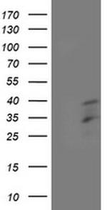 HOXC11 Antibody in Western Blot (WB)