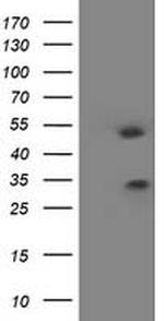 HOXC11 Antibody in Western Blot (WB)