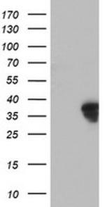 HOXC11 Antibody in Western Blot (WB)